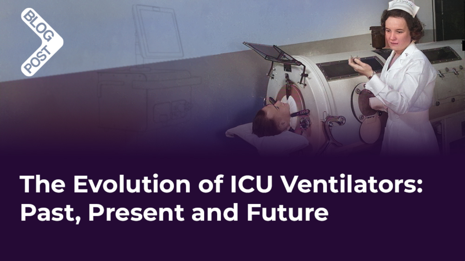 Evolution of ICU Ventilators