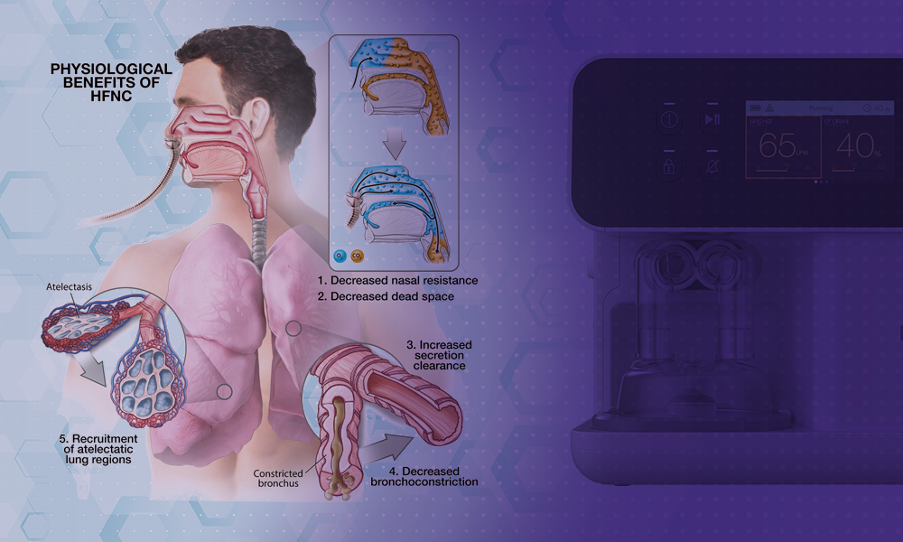 Mechanism of High-Flow Nasal Cannula photo1