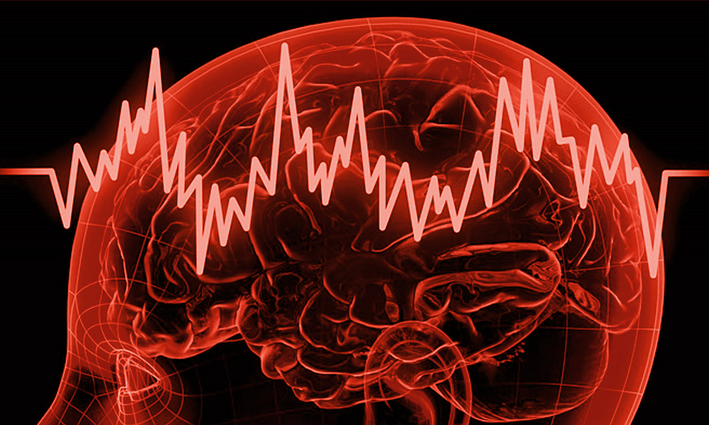 intraoperative neuromonitoring photo 3